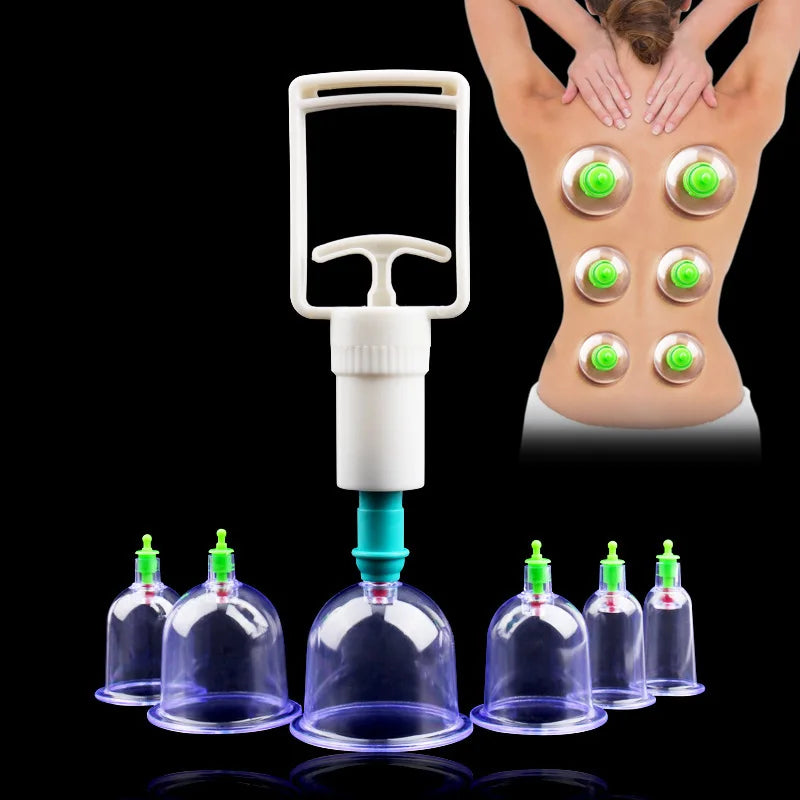 Un set professionnel de thérapie par succion, montrant une coupe maniable et plusieurs tasses en verre sur fond noir.