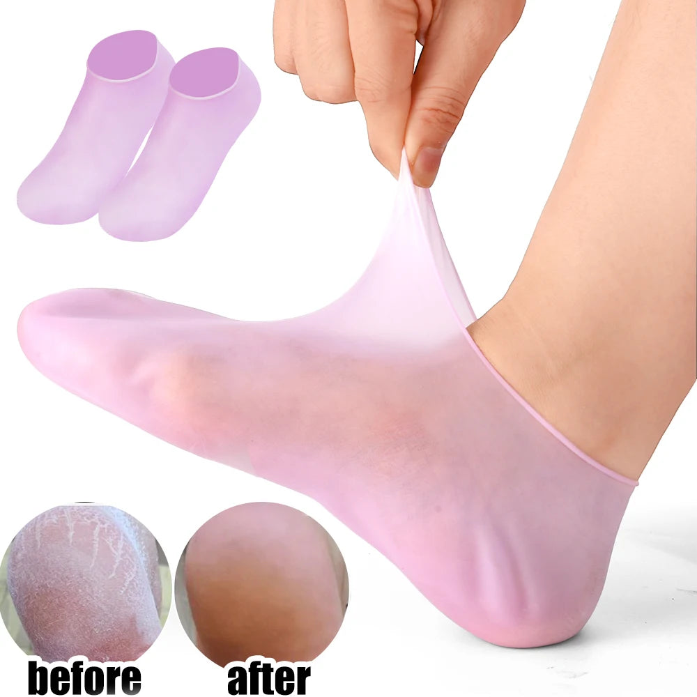 Rosa Silikonsocken zur Feuchtigkeitsversorgung der Füße, zeigen Vorher-Nachher bei trockener Haut.