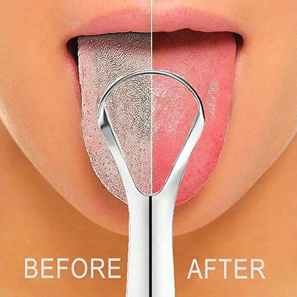 Before and after comparison of a stainless steel tongue scraper used for oral hygiene