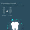 Diagram showing the difference in diameter between toothbrushes, emphasizing deep cleaning teeth.