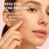 Une femme applique un patch hydrocolloïde rose sur sa joue.