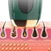 Cross-section view of an electric hair removal epilator device positioned over human skin, showing hair follicles.