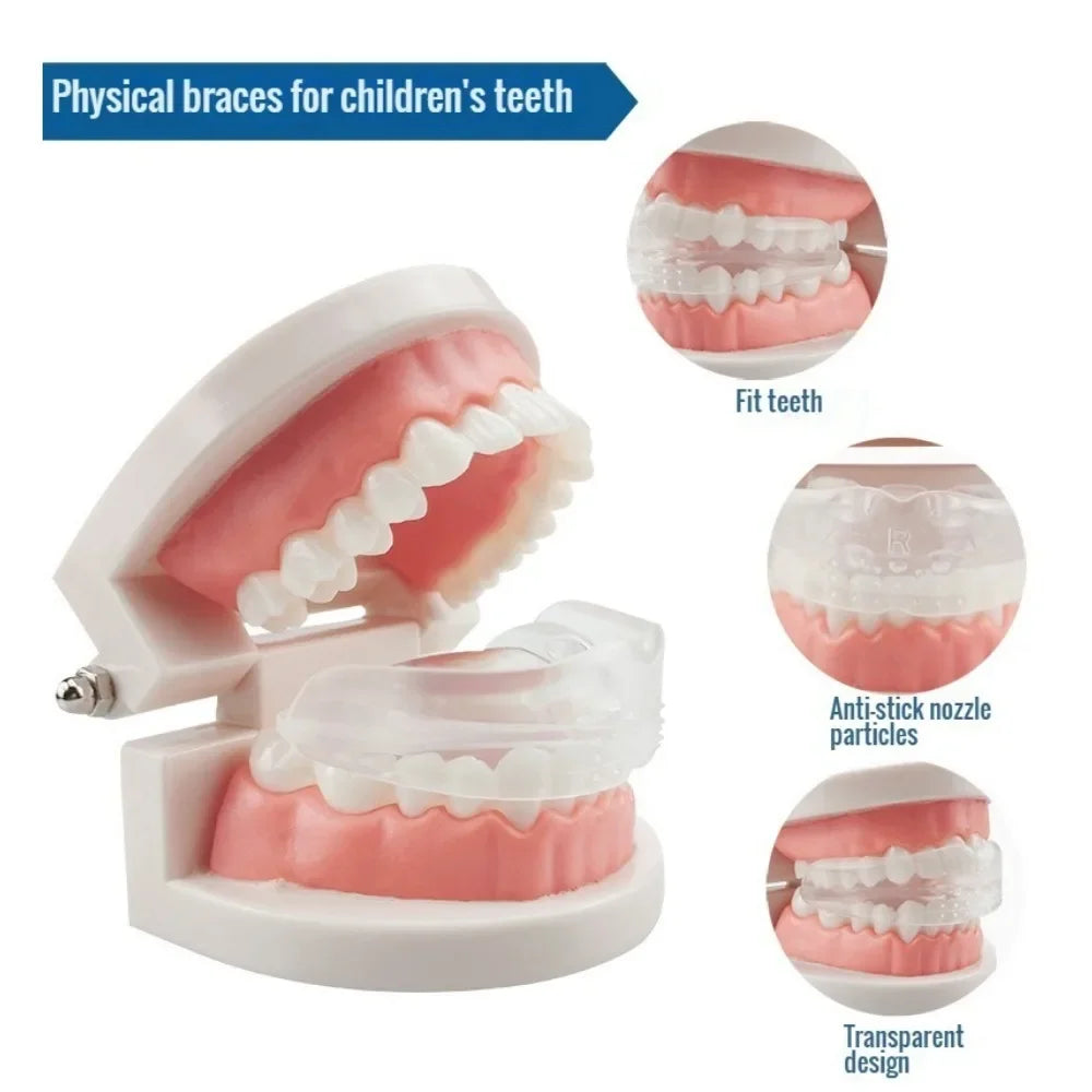 Physical braces for children's teeth showing various fit and design options.