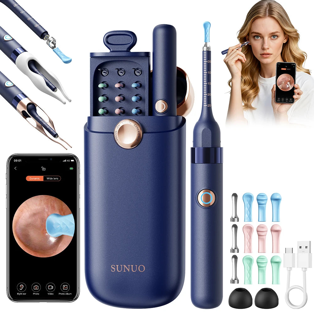 A blue advanced ear cleaning kit with a camera and various cleaning tools is shown next to a woman using a smartphone.
