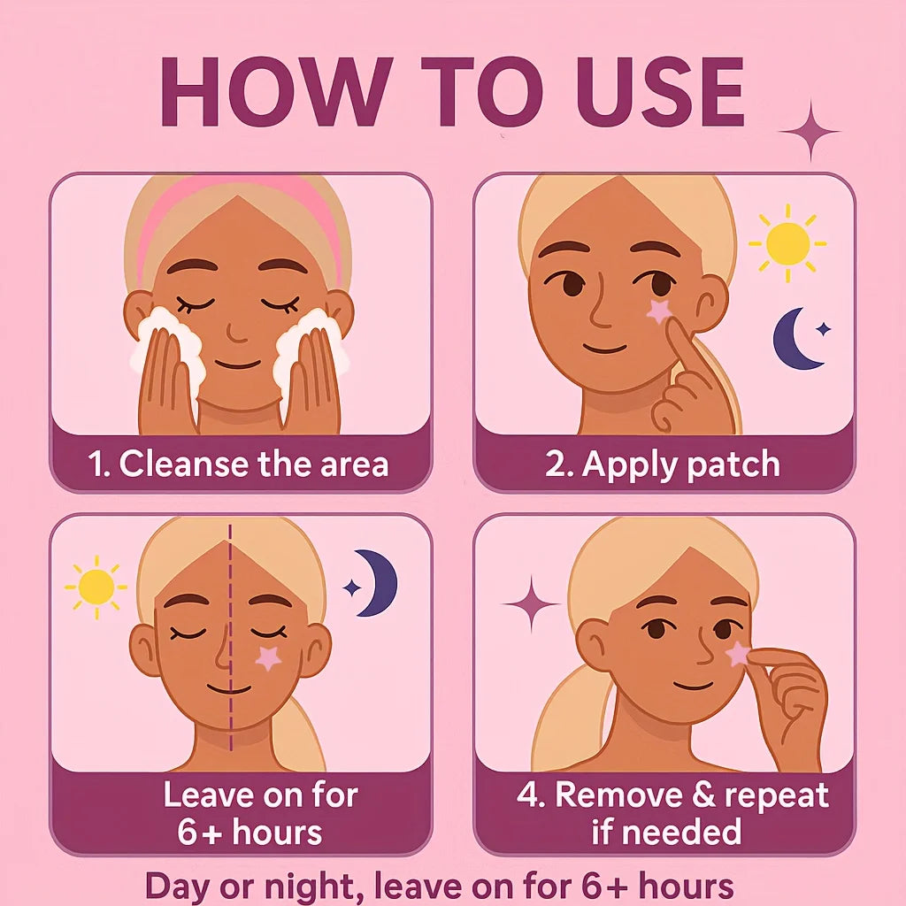 Instructions pour utiliser un kit de patchs hydrocolloïdes anti-acné : nettoyage, application, pose et retrait.