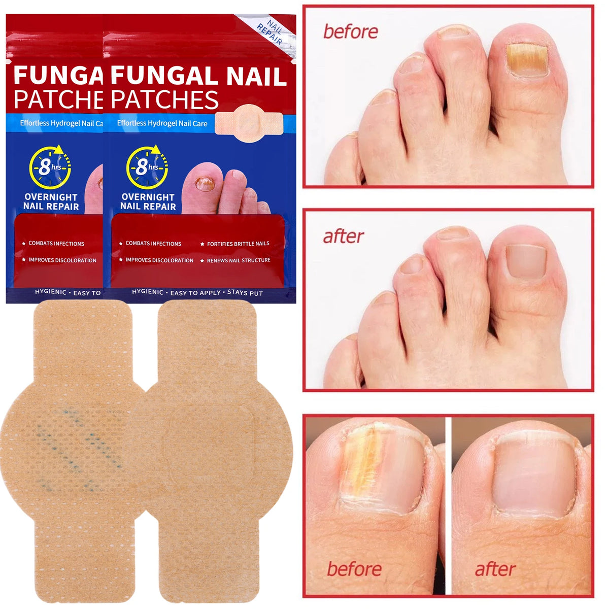 Empaque y aplicación de parches de uñas fúngicas Funga para reparación nocturna de uñas, resultados antes y después.