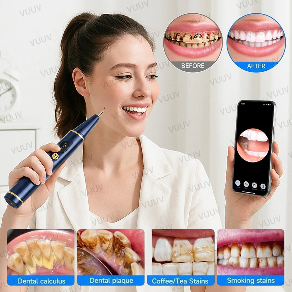 A woman demonstrates an ultrasonic dental scaler tool for tartar removal, showing before and after results.