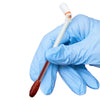 A gloved hand holds an instant iodine swab with a white tip and brown stick for wound care.