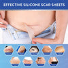 A hand applies a silicone scar sheet to a person's skin to treat various types of scars.