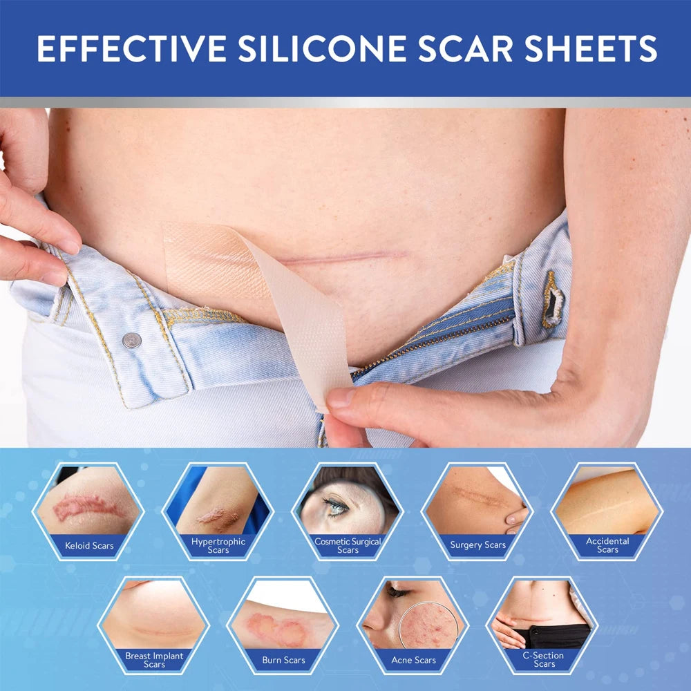 A hand applies a silicone scar sheet to a person's skin to treat various types of scars.