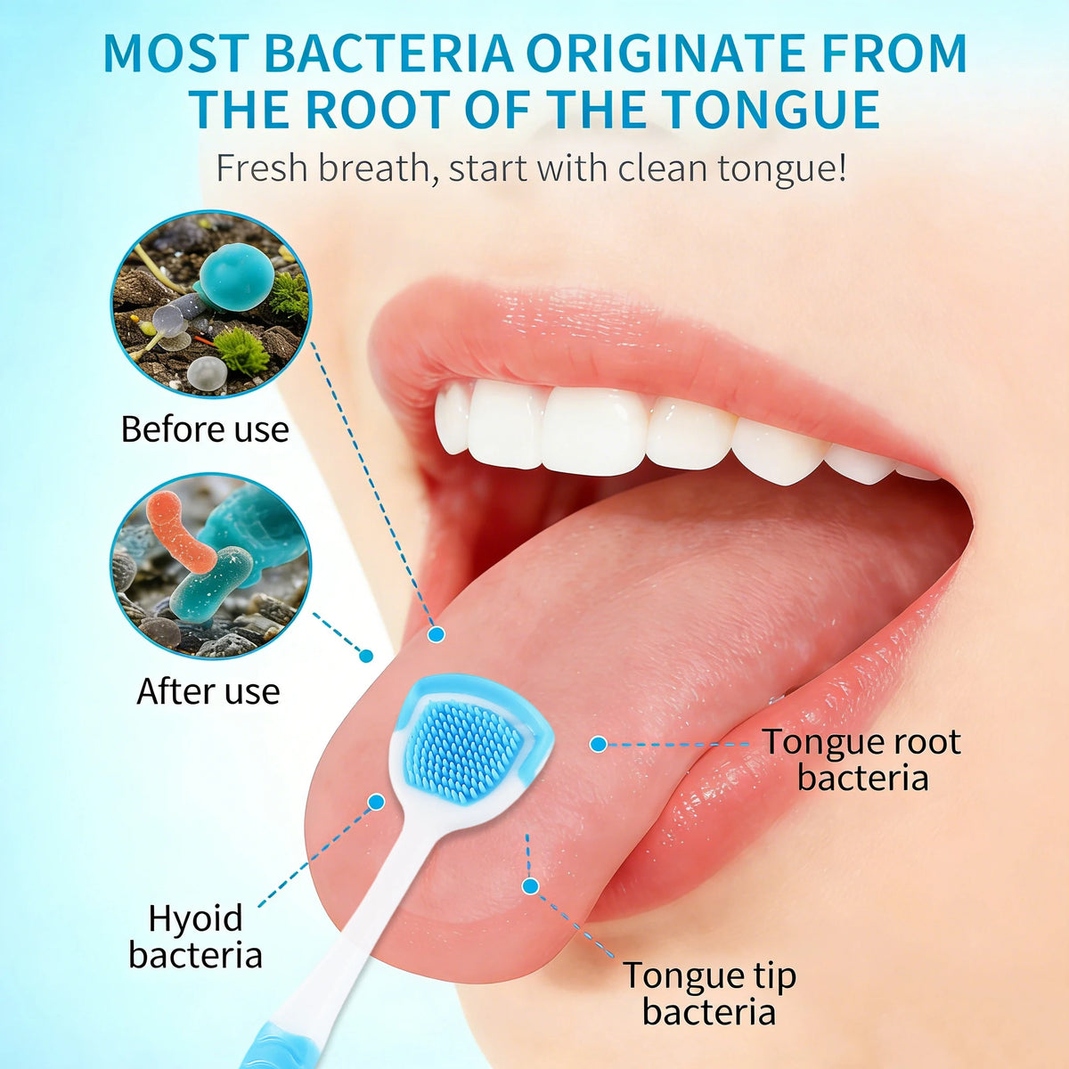 A reusable blue tongue scraper is shown being used on a person's tongue to remove bacteria.
