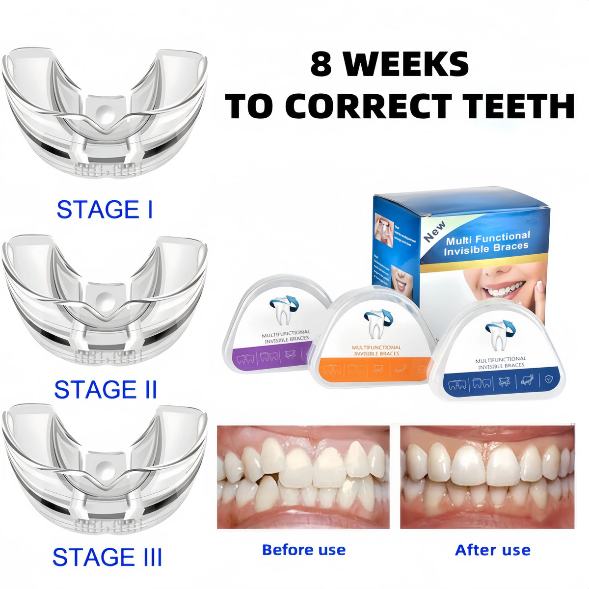 Guide showing three stages of tooth correction using multifunctional silicone dental alignment braces