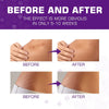 Before and after images showing scar reduction results using medical-grade reusable silicone scar sheets.