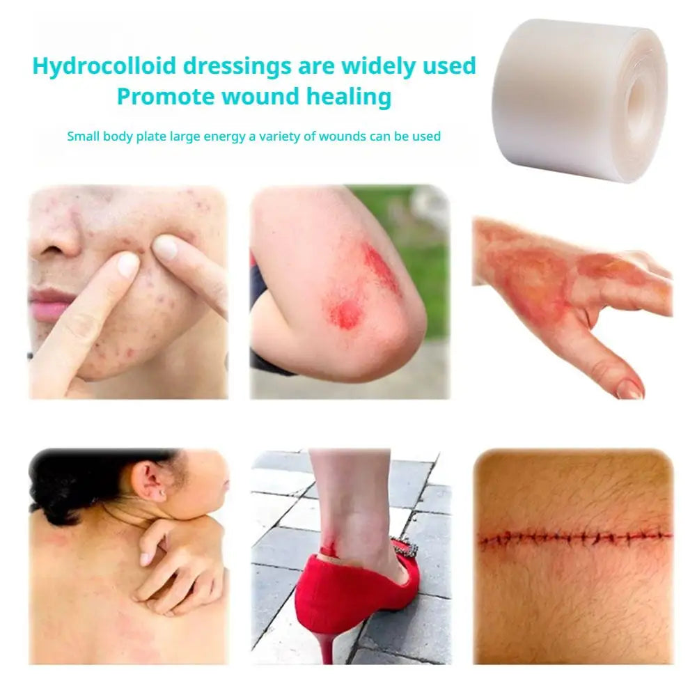 Roll of hydrocolloid dressings shown next to various applications on skin and wounds.