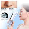 A woman uses a handheld device to clean skin pores, demonstrating before and after results for pore cleansing.