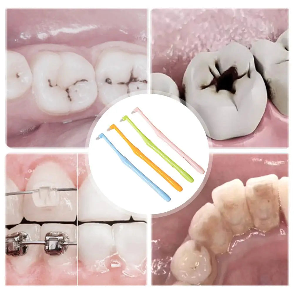 Un juego de cepillos interdentales de doble punta con puntas de varios colores, junto a modelos dentales y brackets.