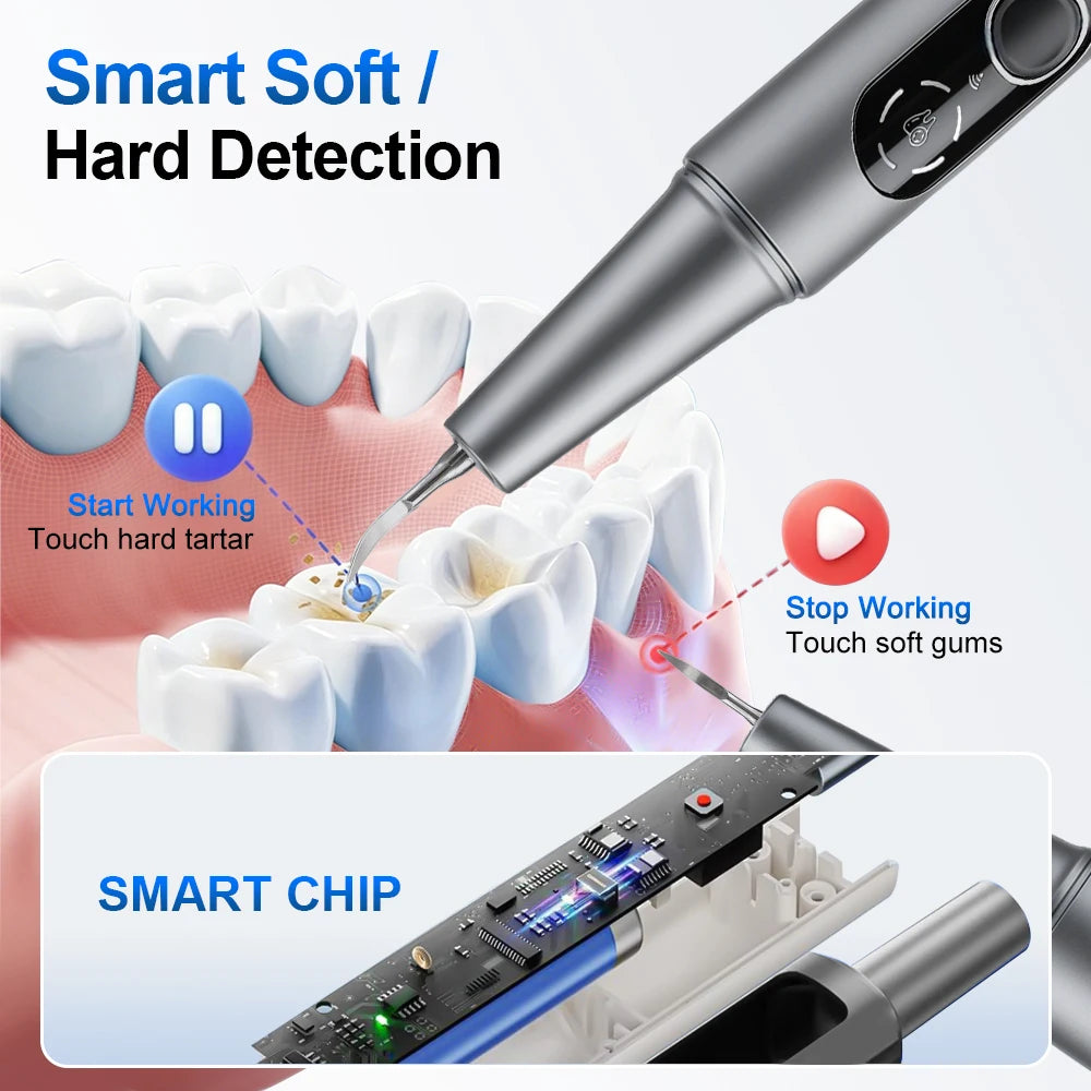Primer plano de la punta de un escalador dental ultrasónico de detección suave y dura, interactuando con los dientes y destac