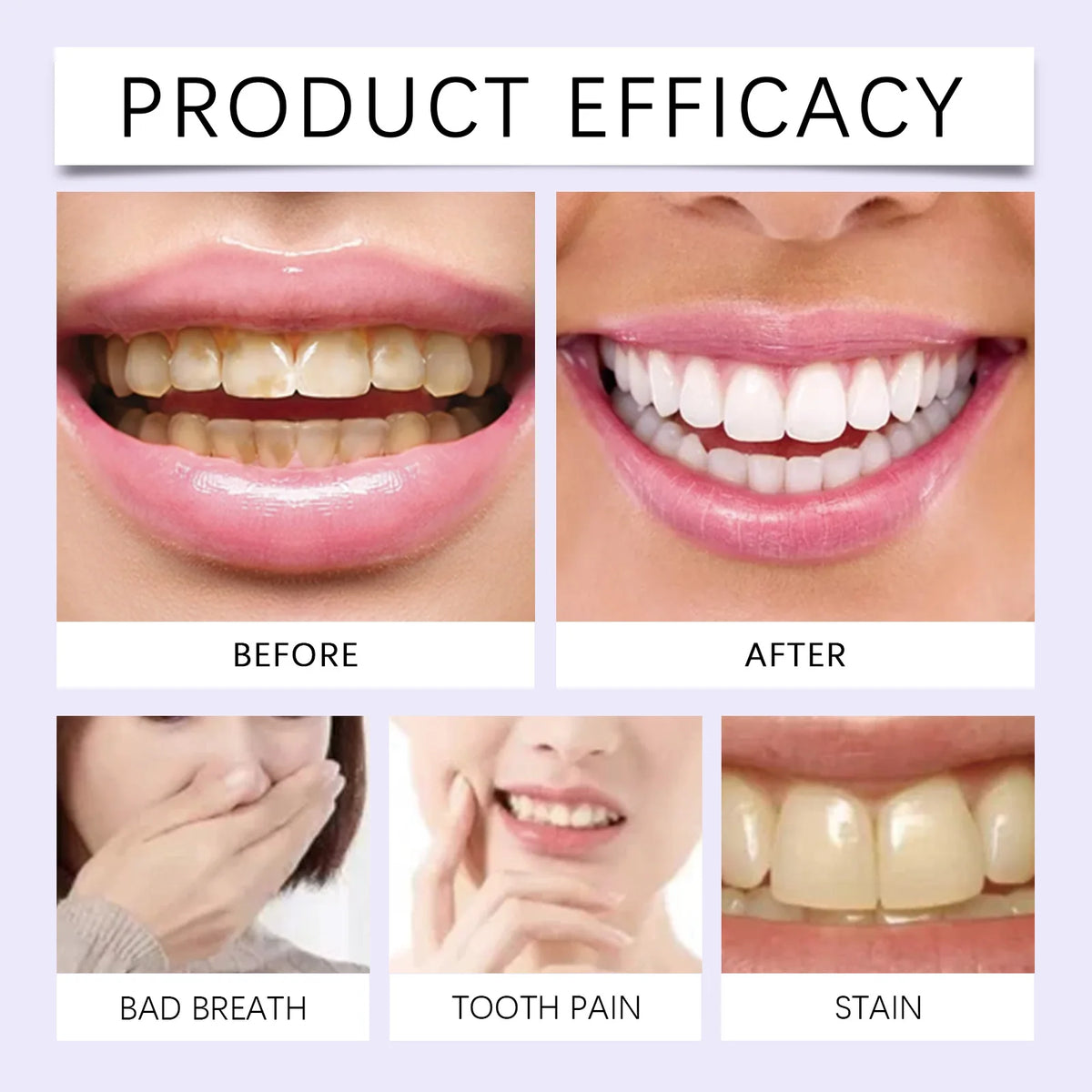 Before and after images showing the effect of natural teeth whitening strips on teeth, breath, and staining.