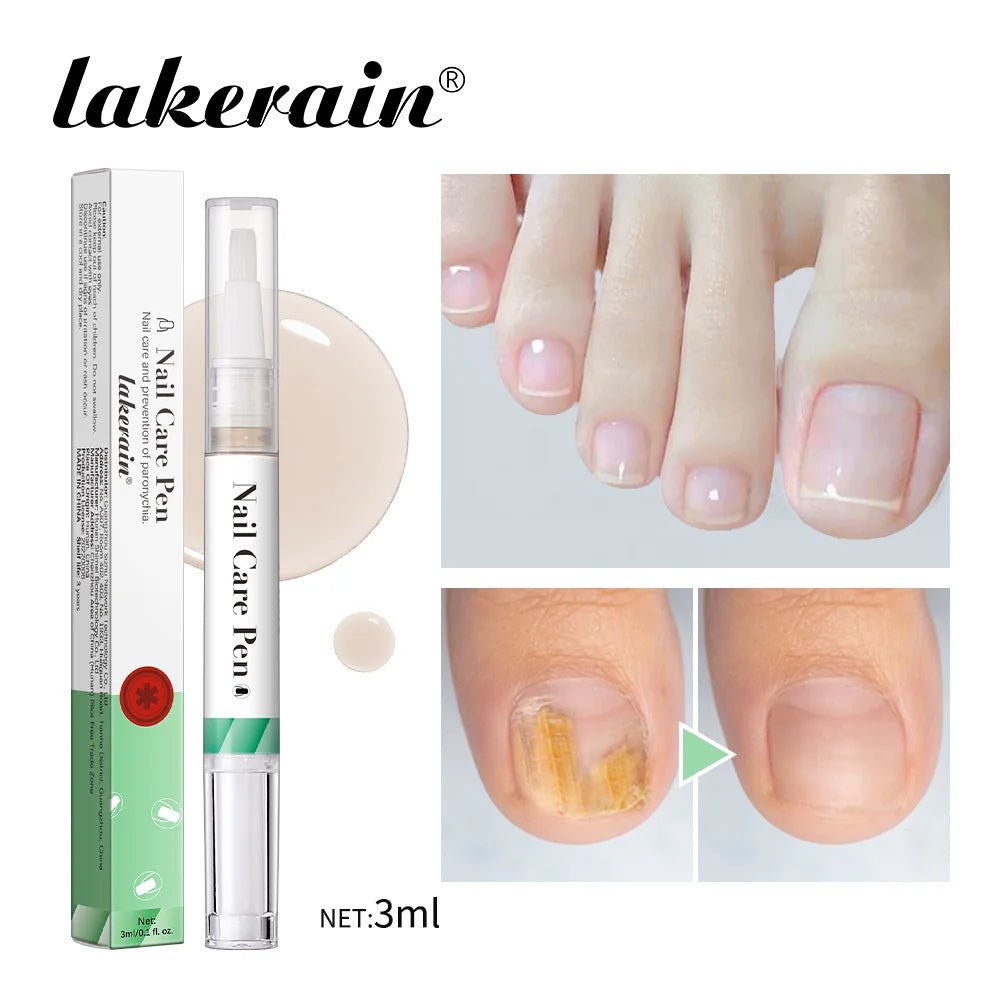 Lakerain Nagellack-Pen zur Tiefenfeuchtigkeitspflege mit Glasapplicator und Nagelflächenproben.