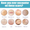 A graphic showing various types of scars including acne scarring, hypertrophic scar, burn scar, stria gravdarum, surgical sca
