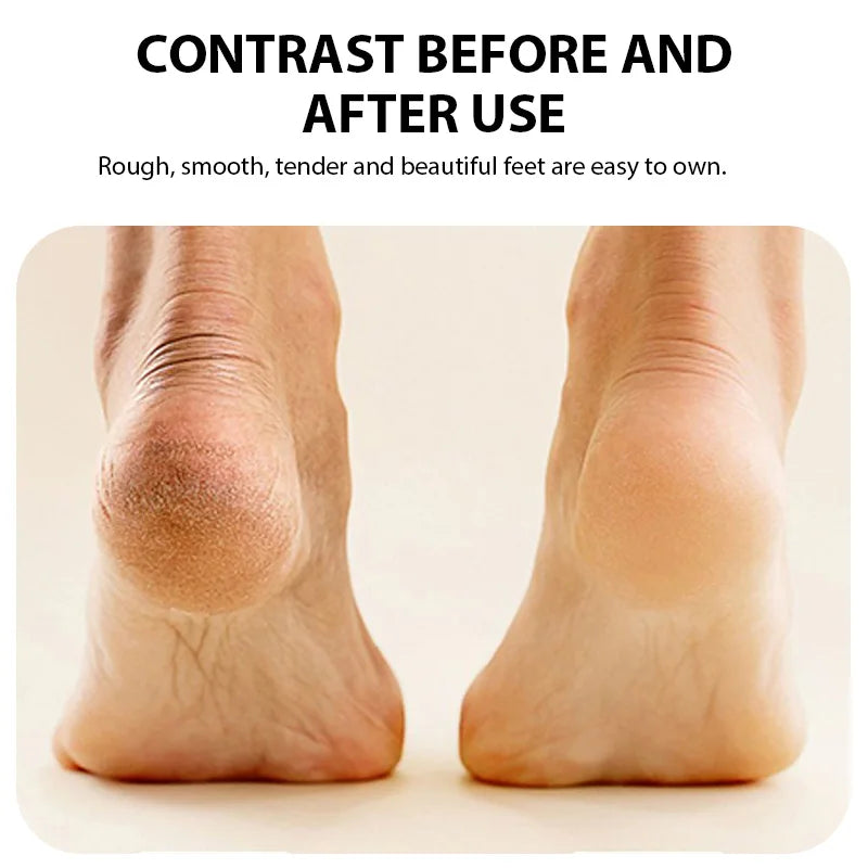 Before and after comparison of feet showing smooth skin after using an electric foot grinder for dead skin removal