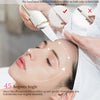 Hands hold an ultrasonic skin scrubber tool on a woman's face for exfoliation.