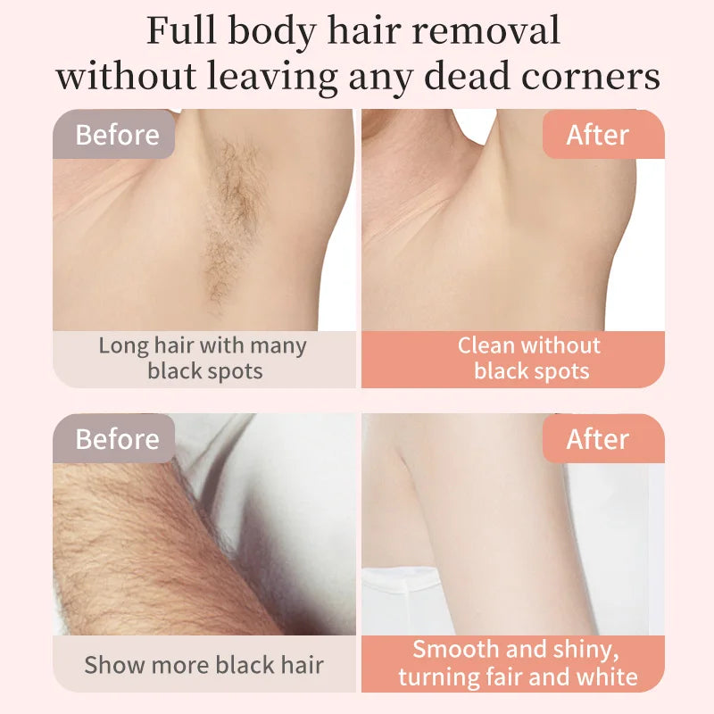 Before and after images showing full body hair removal, demonstrating the removal of black spots and resulting smooth, fair s