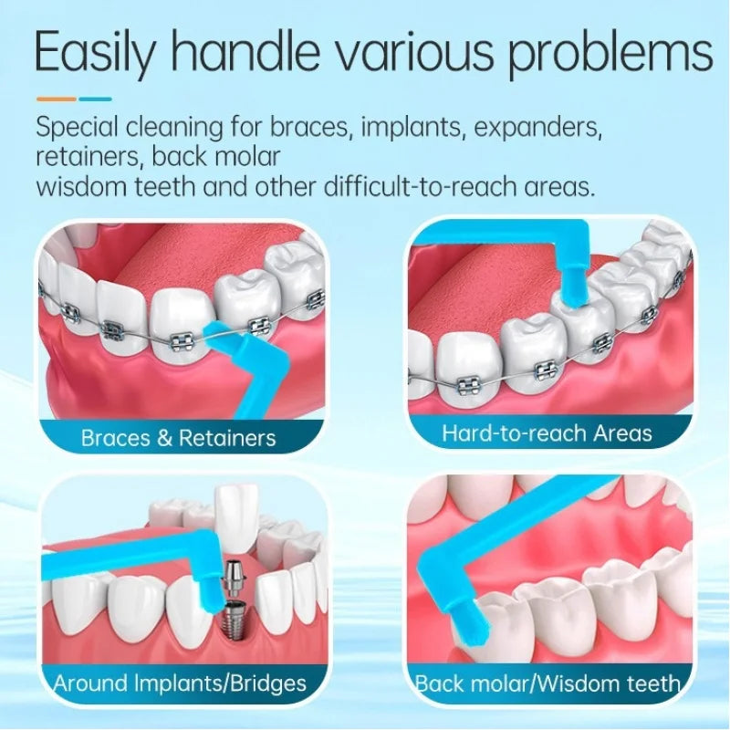 Single-Tufted Orthodontic Interdental Toothbrush