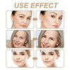 Before and after comparison showing the use effect of kinesiology tape for wrinkle reduction on facial skin.