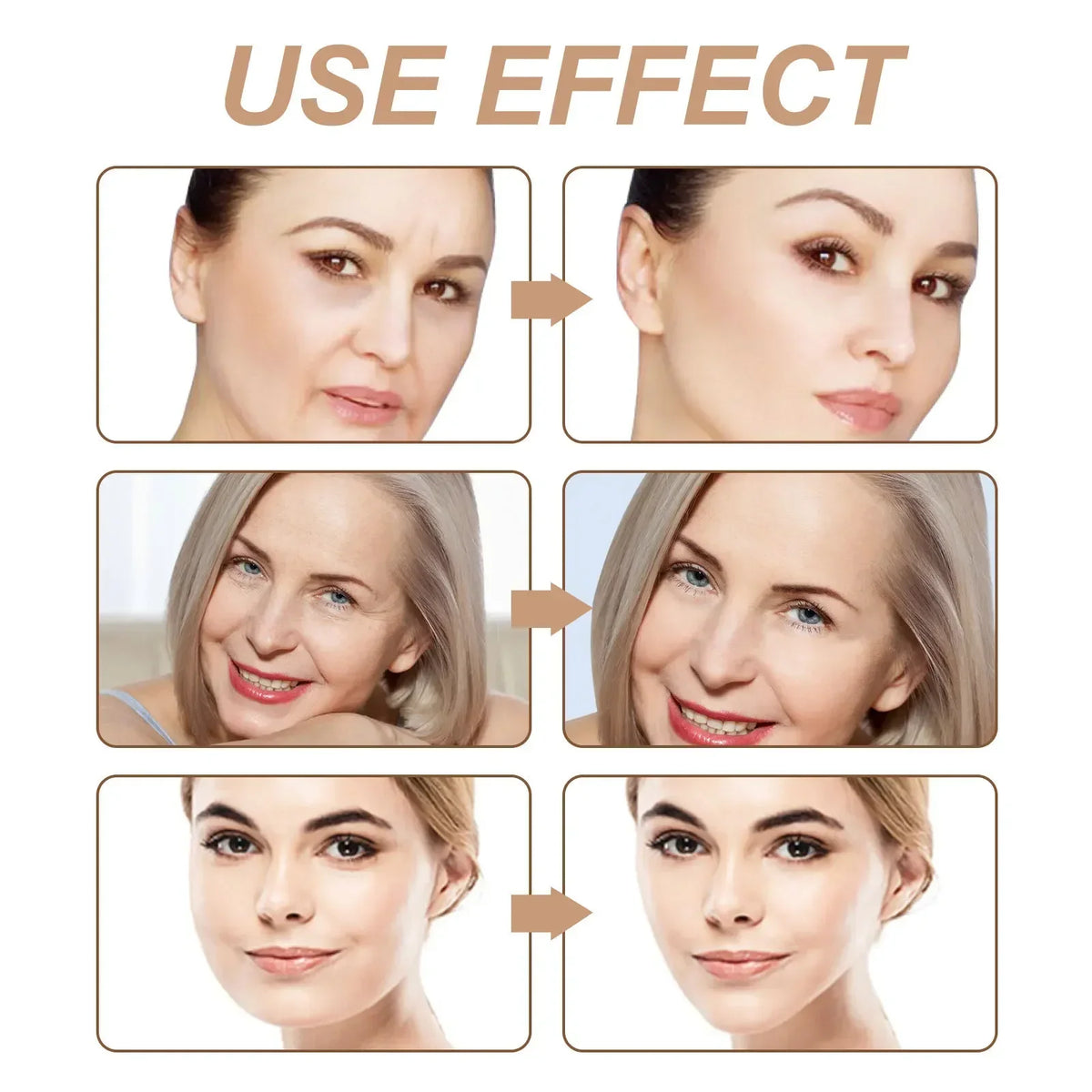 Before and after comparison showing the use effect of kinesiology tape for wrinkle reduction on facial skin.