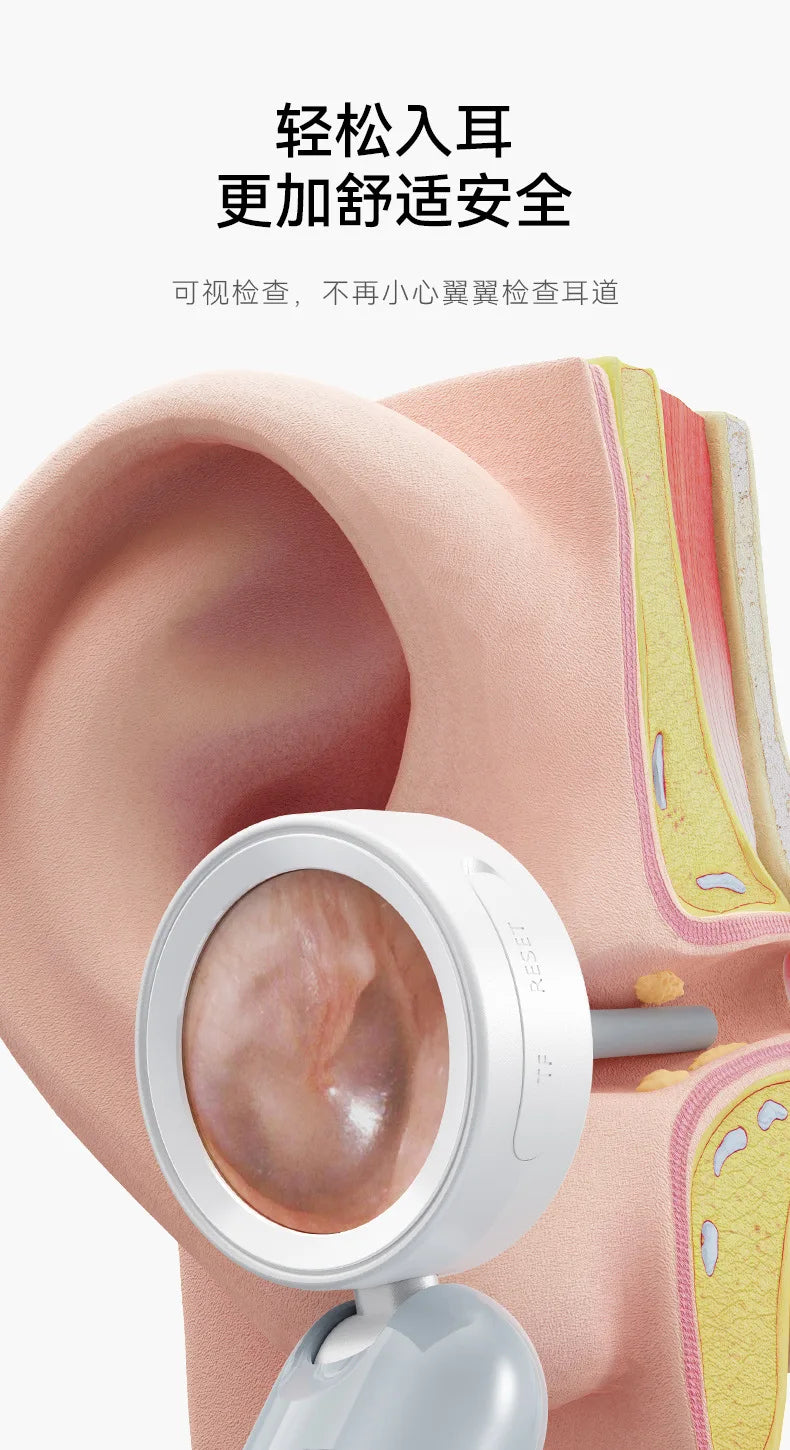 A white portable HD ear camera is shown inspecting the ear of a pink-toned model.