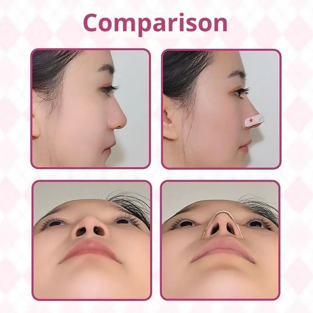 Comparison of invisible nose lifting patches showing before and after results on a woman's face.