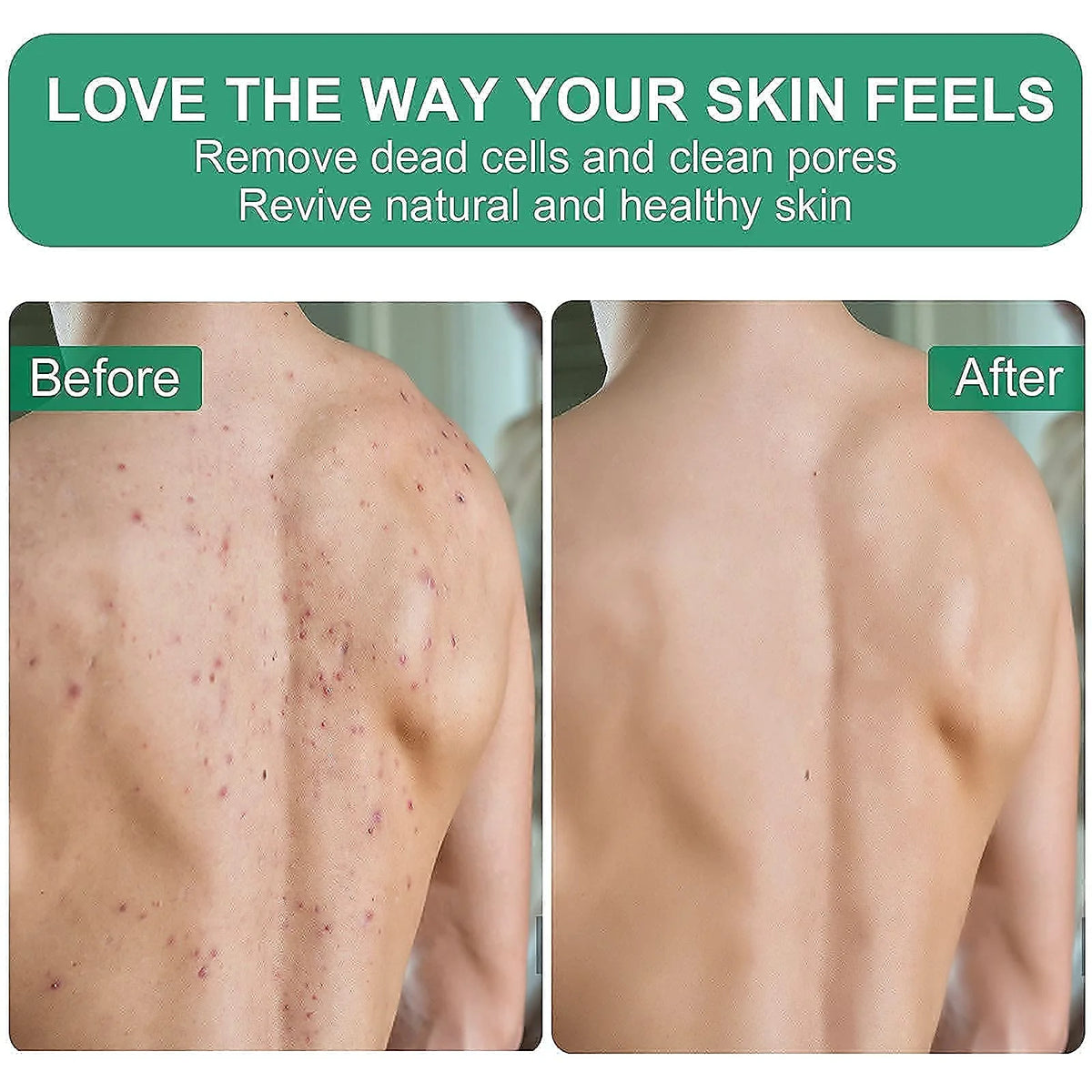 Before and after comparison showing skin exfoliation results on the back of the arm