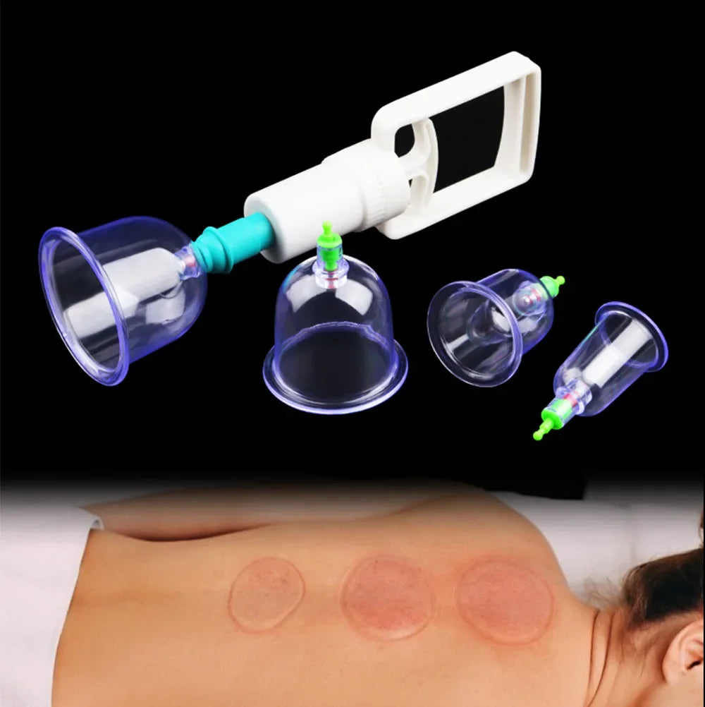 Un kit de thérapie par succion professionnelle avec un tube et une coupe, monté au-dessus de l'épaule d'une personne.