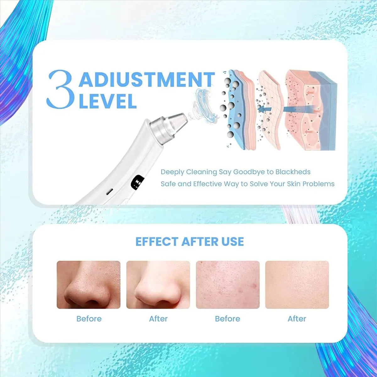 A white facial device for deep cleaning blackheads and pores, showing before and after skin results.