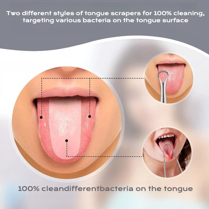 Two different styles of stainless steel tongue scrapers for cleaning bacteria on the tongue surface