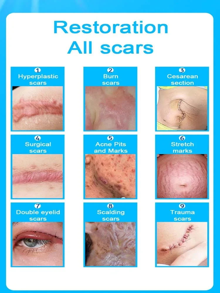 A grid showing nine types of scars including hyperplastic, burn, and surgical scars, along with acne pits, stretch marks, and