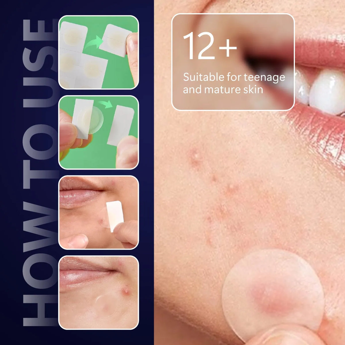 Close-up of hydrocolloid pimple patches being applied to skin, showing usage and suitability for mature skin.