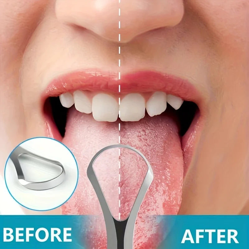 Before and after comparison showing a portable stainless steel tongue scraper set used for oral hygiene.