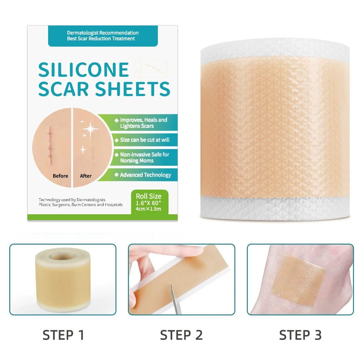 Three steps showing how to use silicone scar sheets for scar reduction treatment