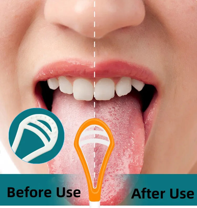 Comparaison avant/après d'un nettoyant pour la langue en silicone pour l'hygiène buccale