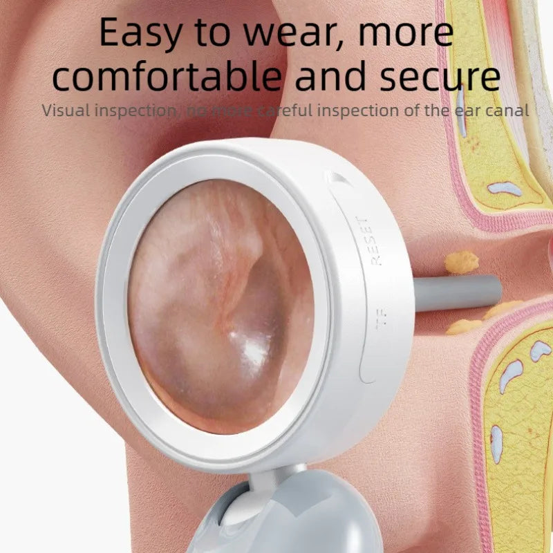 A white portable HD ear camera is shown being used for visual inspection of the ear canal.
