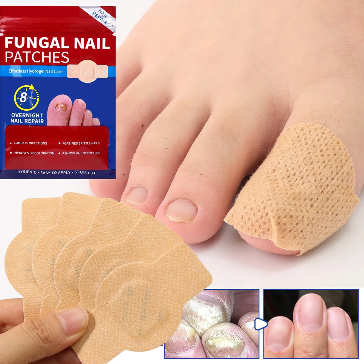 Una mano aplica un parche impermeable beige en una uña del pie, mostrando varios parches para reparación nocturna de uñas.
