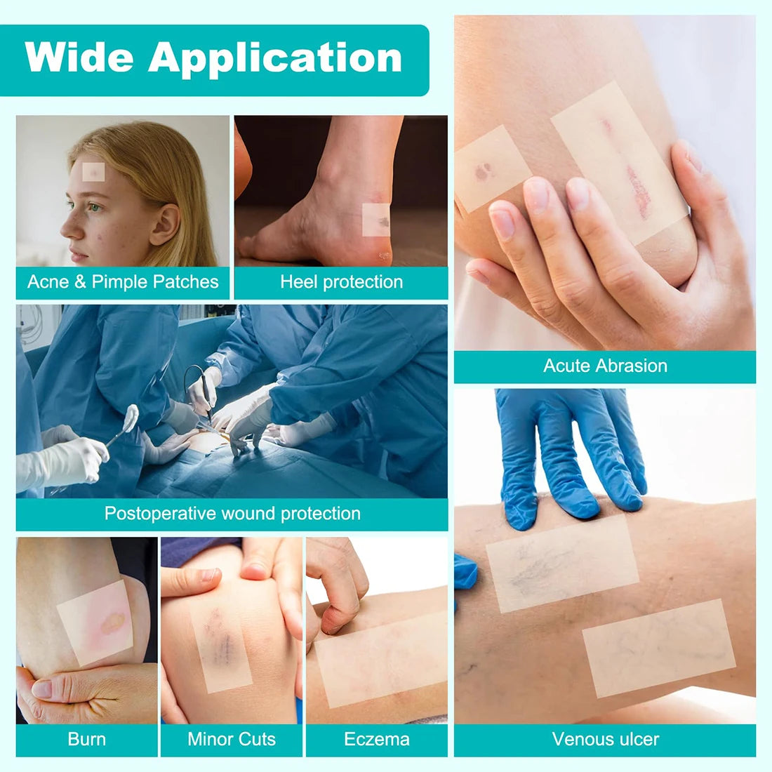Various hydrocolloid patches are shown being applied to skin for acne, heel protection, wounds, burns, and ulcers.